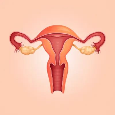 Illustration endo - Image 1