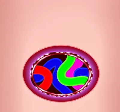 Illustration eviscerated - Image 1