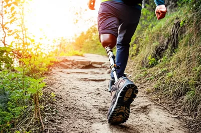 Illustration prosthetic