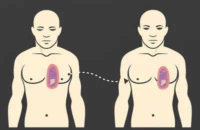 Illustration transplant - Image 1