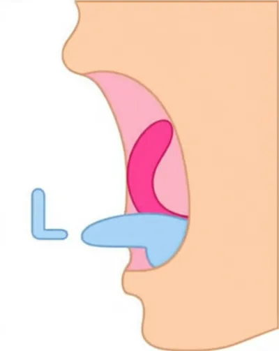 Illustration velarize