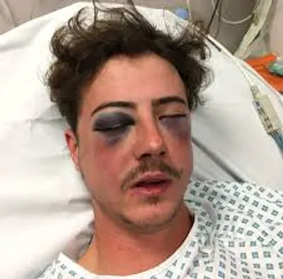 Illustration beaten - Image 2