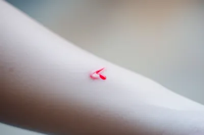 Illustration bleeds - Image 1