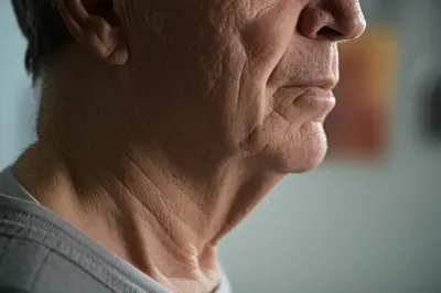 Illustration dewlap - Image 1