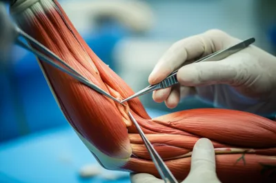 Illustration dissecting - Image 1