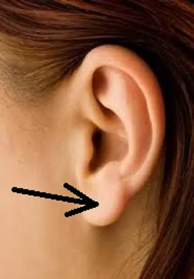 Illustration earlobe - Image 2