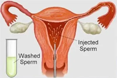 Illustration insemination - Image 2