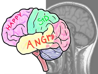 Illustration schematic - Image 1