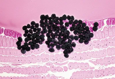 Illustration invasive - Image 1