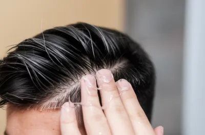 Illustration gelling - Image 1