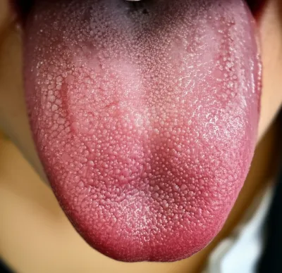 Illustration papilla - Image 1