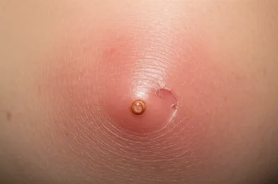 Illustration point - Image 1