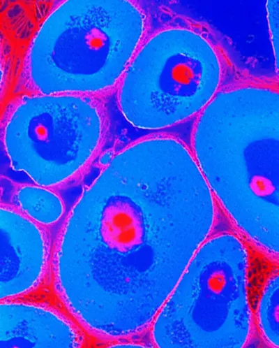 Illustration counterstain