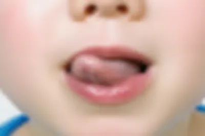 Illustration lisps - Image 1