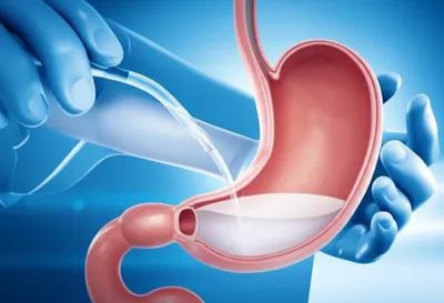 Illustration lavage - Image 1