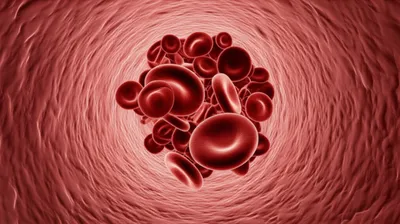 Illustration clot - Image 1