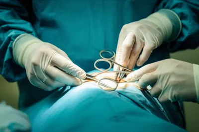 Illustration maneuvers - Image 1