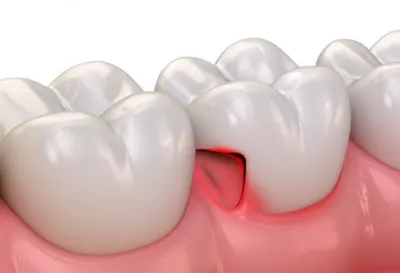 Illustration pockets - Image 1