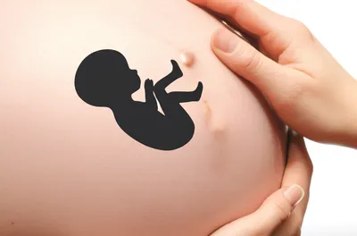 Illustration repercussions - Image 1