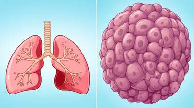 Illustration hyperplasia