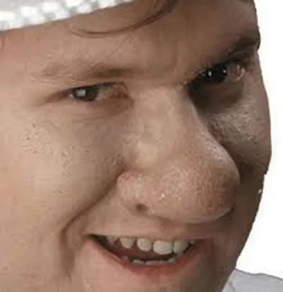 Illustration bulbous - Image 3