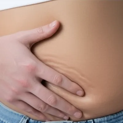 Illustration fluctuations - Image 1