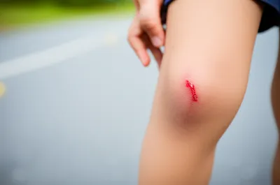 Illustration grazes - Image 1