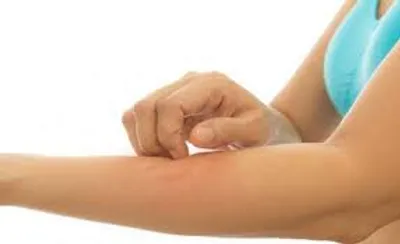 Illustration prickle - Image 2