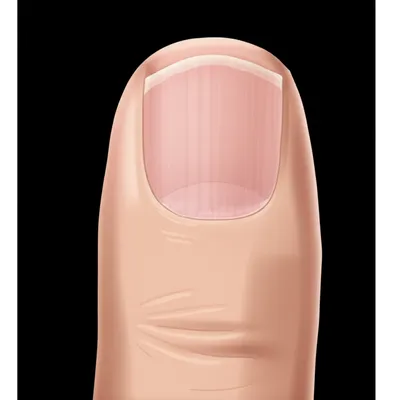 Illustration nail