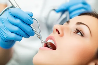 Illustration suction - Image 1