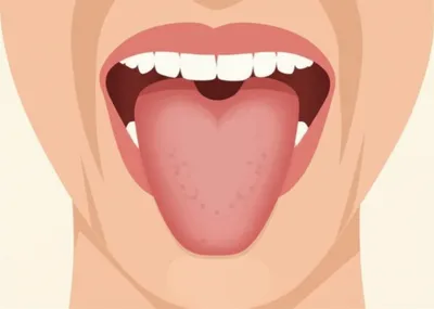 Illustration fronted - Image 1