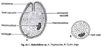 Illustration cyst - Image 2
