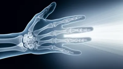 Illustration radiographs