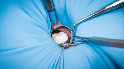 Illustration dams - Image 1