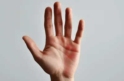 Illustration smacking - Image 1