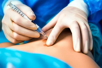 Illustration anesthetist