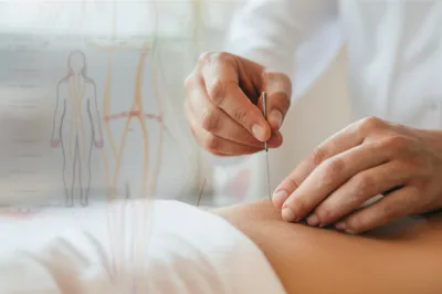 Illustration acupuncturist