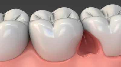 Illustration pocket - Image 1