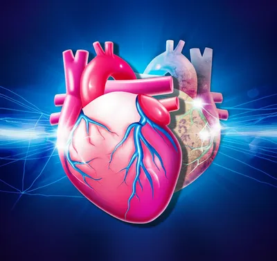 Illustration transplant - Image 1