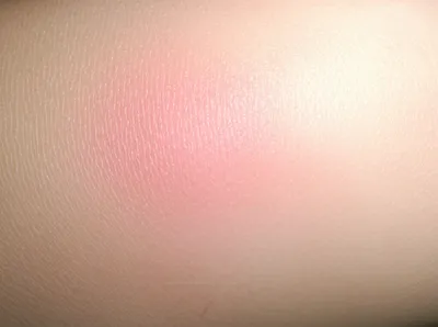 Illustration chafe - Image 1