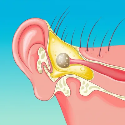 Illustration maculae - Image 1