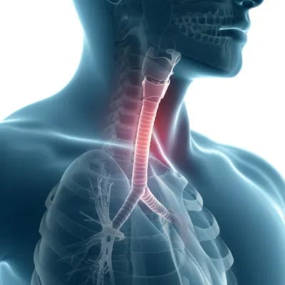 Illustration airways