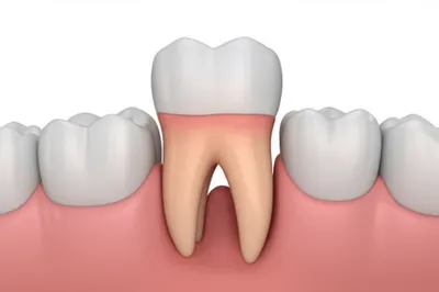 Illustration impacted - Image 1