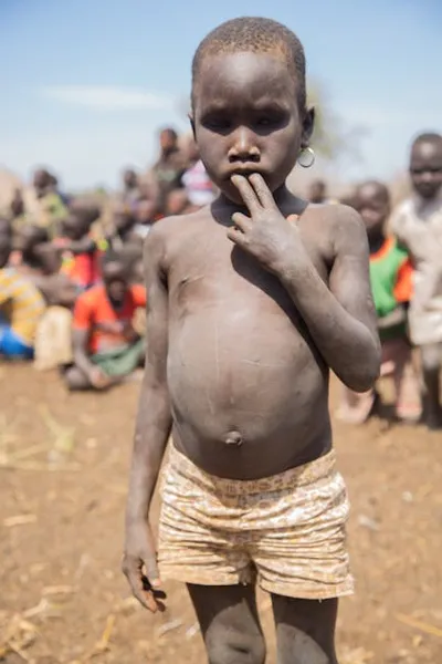 Illustration distending - Image 2