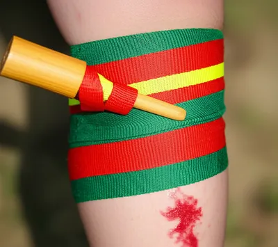 Illustration tourniquet