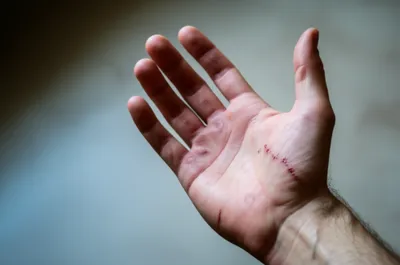 Illustration stigma - Image 1