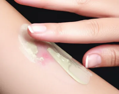 Illustration salve - Image 1