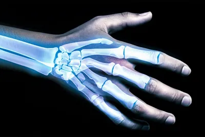 Illustration twinge - Image 1