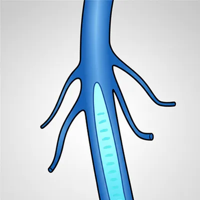 Illustration vessel - Image 1