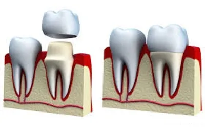 Illustration crown - Image 3
